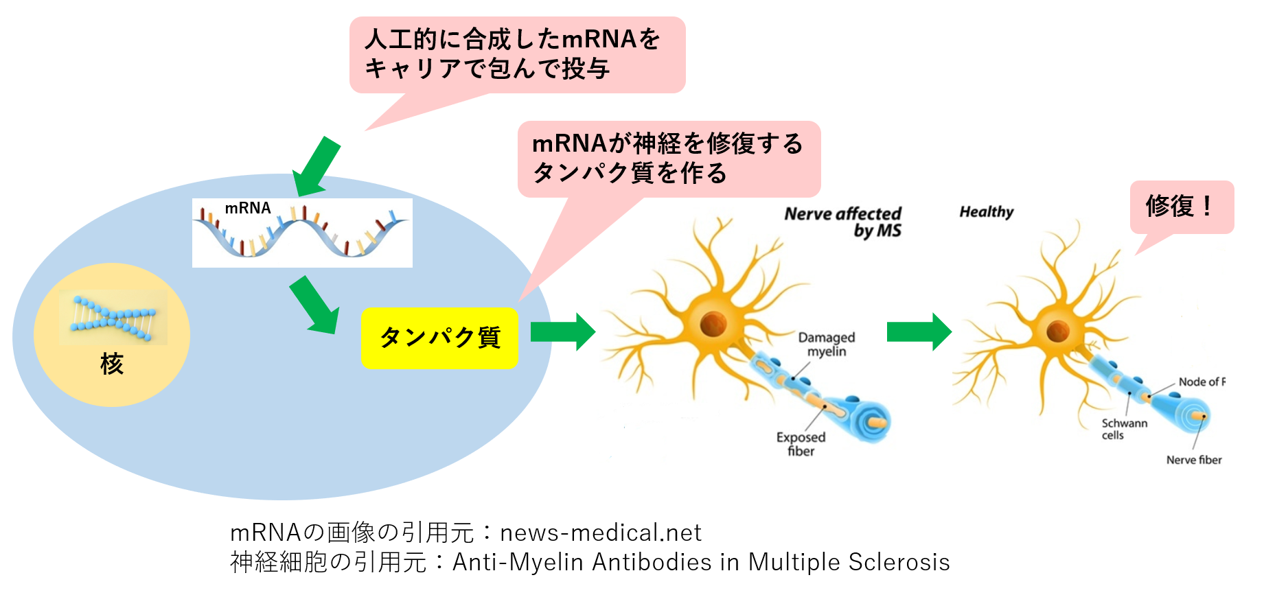 世界初 Mrna医薬により脊髄損傷マウスの運動機能が回復 神経再生医療に光 Ayumi Media 生き抜く子供を育てたい